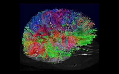 Breve Historia de los Reflejos Primitivos II